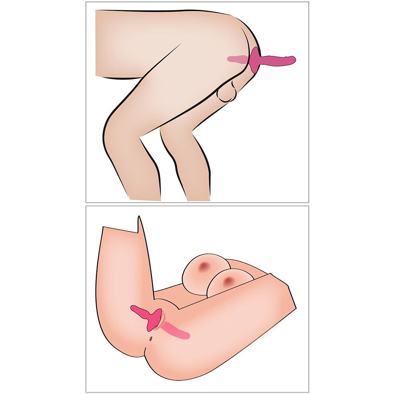 Couples Choice - 2 in 1 Vibraattori