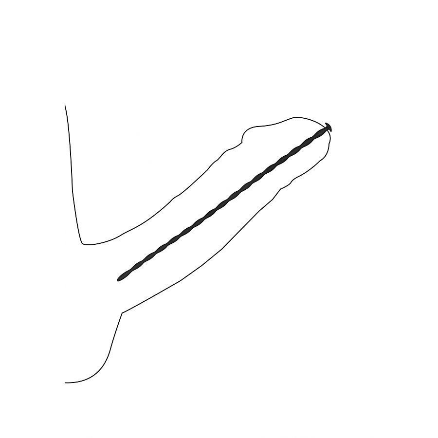 Ouch - Spiraalisondit, 4 kpl