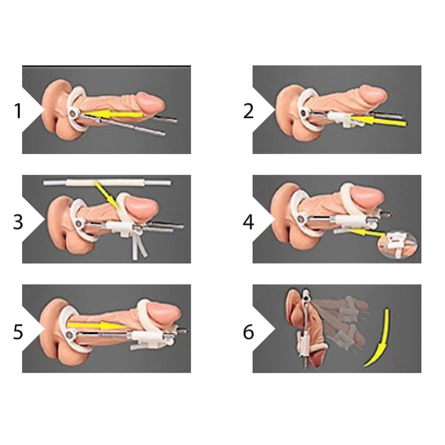 Pumped Penis Extender - Peniksen pidennyslaite