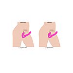 STRAP U - Evoke Ergo-Fit strapless strap-on
